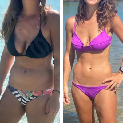 Giovanna — antes e depois