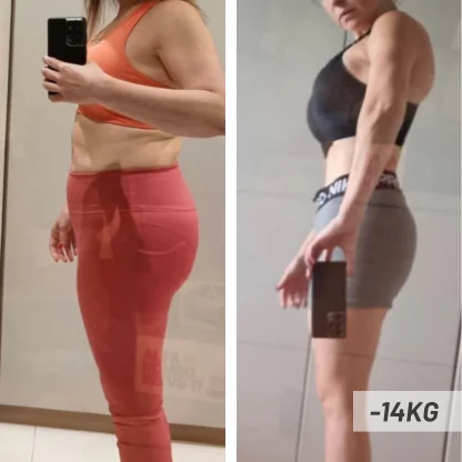 Giselle — antes e depois