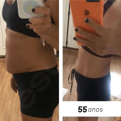 Telma — antes e depois